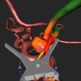 Distance and Force Visualisations for Improved Simulation of Intracranial Aneurysm Clipping