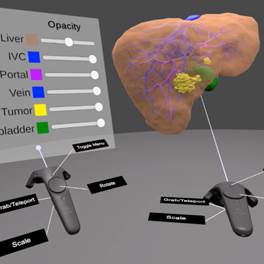 Using Virtual 3D-models in Surgical Planning: Workflow of an Immersive Virtual Reality Application in Liver Surgery
