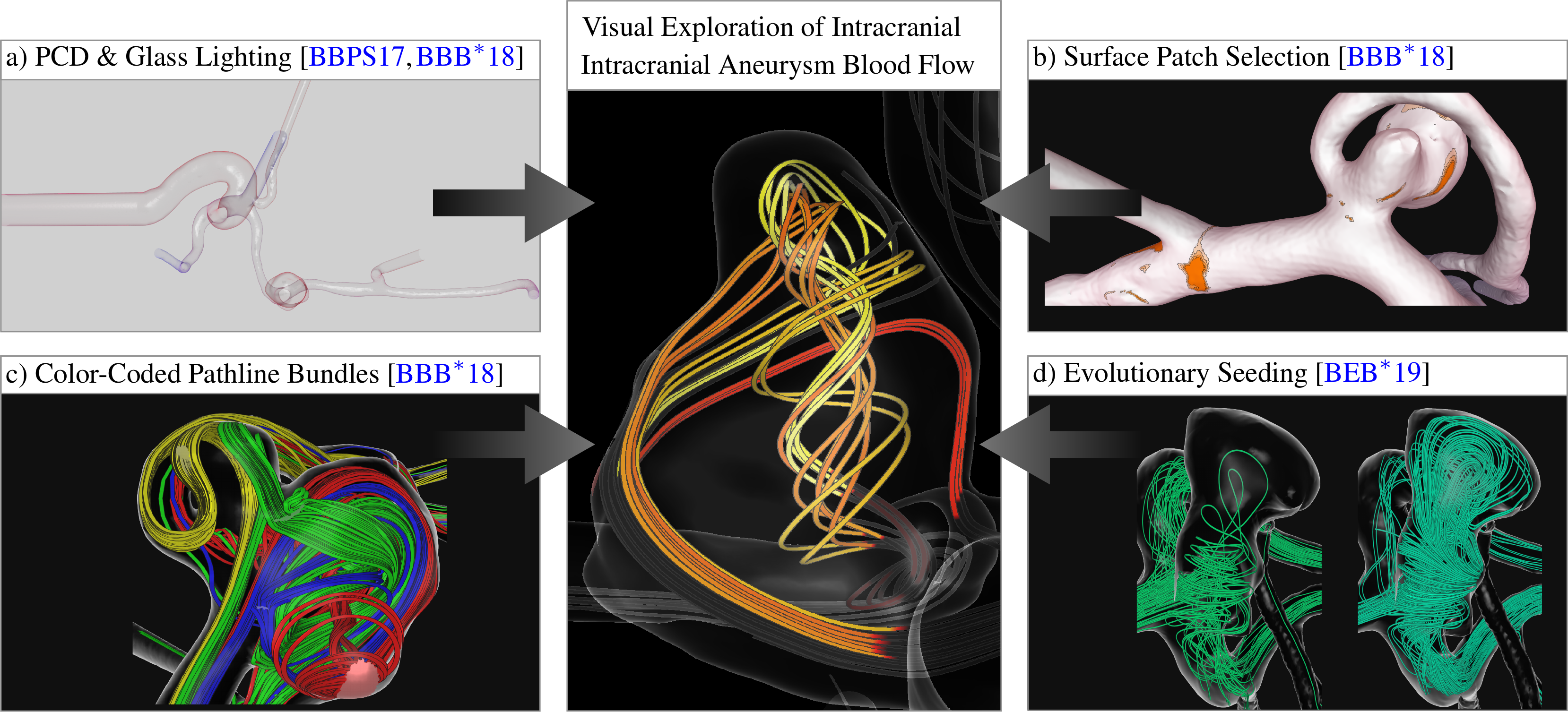 Visual exploration of intracranial aneurysm blood flow adapted to the clinical researcher