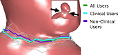 VICTORIA: VIrtual neck Curve and True Ostium Reconstruction of Intracranial Aneurysms