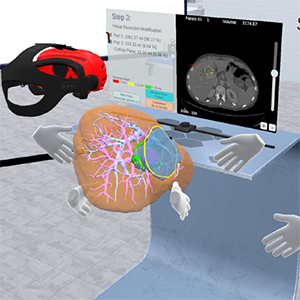 A collaborative virtual reality environment for liver surgery planning