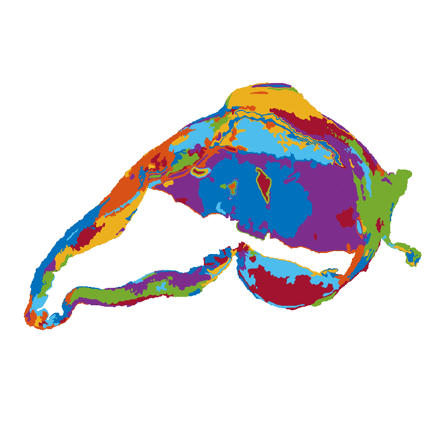 Tissue segmentation in histologic images of intracranial aneurysm wall