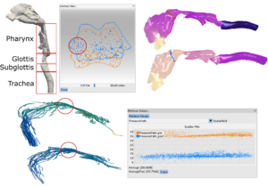COMFIS - Comparative Visualization of Simulated Medical Flow Data