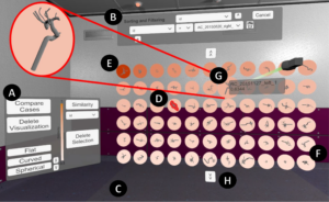 Design of a virtual data shelf to effectively explore a large database of 3D medical surface models in VR