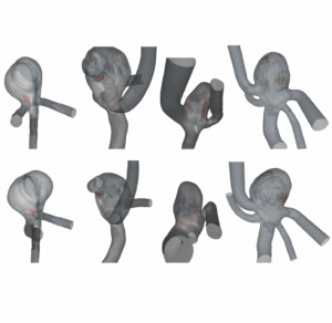 Automatic Animations to Analyze Blood Flow Data