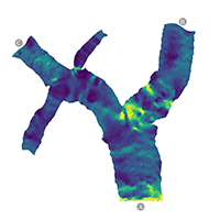 Automatic Cutting and Flattening of Carotid Artery Geometries