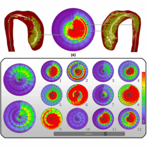 A Survey of Flattening Based Medical Visualization Techniques