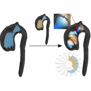 On the Evaluation of a Semi-Automatic Vortex Flow Classification in 4D PC-MRI Data of the Aorta