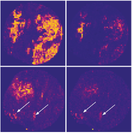 Predicting the HER2 status in oesophageal cancer from tissue microarrays using convolutional neural networks