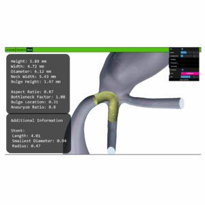 A Web-based Application for the Analysis of Aneurysm Data