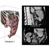 Overlay of Patient-Specific Anatomical Data for Advanced Navigation in Surgery Simulation