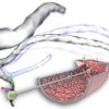 Dynamische Gefäße für interaktive Chirurgiesimulationen