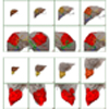 Animation and Interactive Visualization of Patient Individual Data