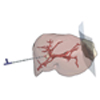 Combining Training and Computerized Planning of Oncologic Liver Surgery