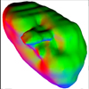 Hardware-Accelerated Stippling of Surfaces Derived from Medical Volume Data