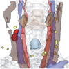 Perception-based Evaluation of Emphasis Techniques Used in 3D Medical Visualization