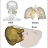Importance-Driven Structure Categorization for 3D Surgery Planning