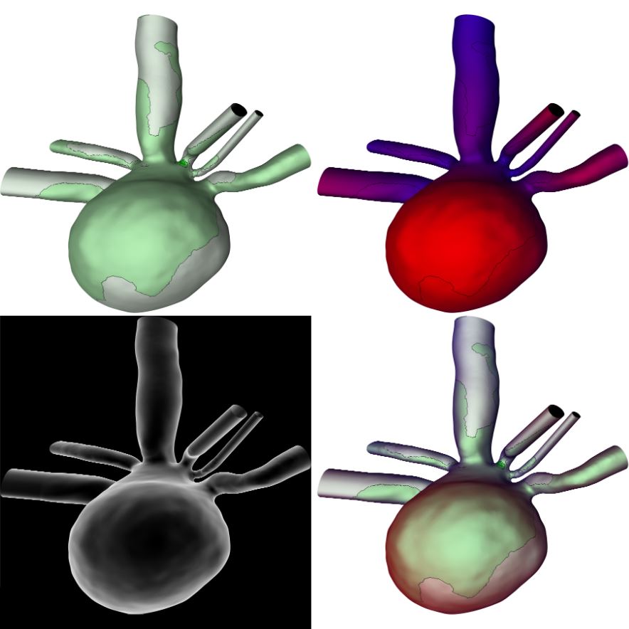 Combining Pseudo Chroma Depth Enhancement and Parameter Mapping for Vascular Surface Models