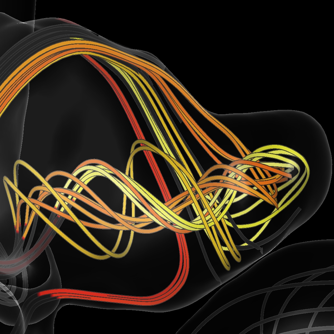 Explorative Blood Flow Visualization using Dynamic Line Filtering based on Surface Features