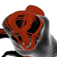 Evolutionary Pathlines for Blood Flow Exploration in Cerebral Aneurysms