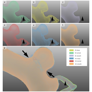 Does the DSA reconstruction kernel affect hemodynamic predictions in intracranial aneurysms? An analysis of geometry and blood flow variations