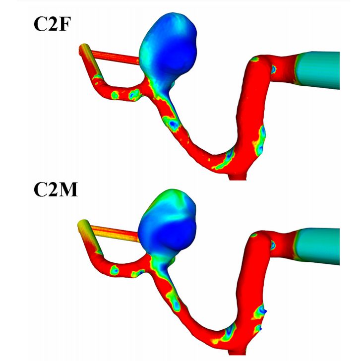 3DRA Reconstruction of Intracranial Aneurysms - How Does Voxel Size Influences Morphologic and Hemodynamic Parameters