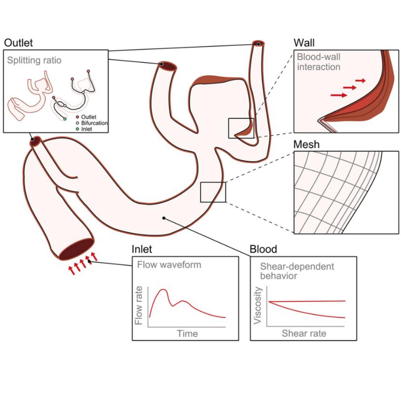 A review on the reliability of hemodynamic modeling in intracranial aneurysms: why computational fluid dynamics alone cannot solve the equation