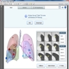 3D-PDF: Ein interaktives Tool für das onkologische Reporting und die Operationsplanung von Lungentumoren