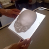 Mobile Interactive Displays for Medical Visualization