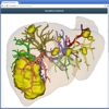 A novel Real-Time Web3D Surgical Teaching Tool based on WebGL