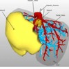 Entwicklung eines Labeling- und Annotationsframeworks für webbasierte medizinische 3D-Visualisierungen