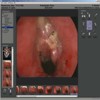 TTM Tumor Therapy Manager