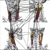 Evaluation of Perception Performance in Neck Dissection Planning using Eye-Tracking