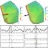 Cardiac Motion Estimation from Intracardiac Electrical Mapping Data: Identifying a Septal Flash in Heart Failure