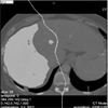 Evaluation of a Training System of the Computer-based Planning of Liver Surgery