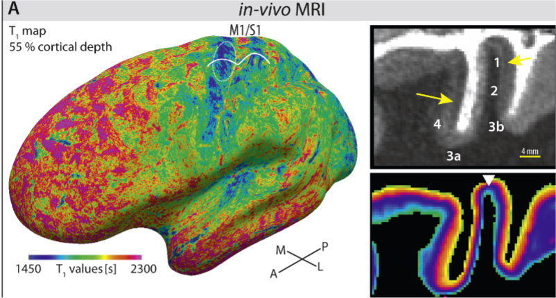 A Cytoarchitecture-driven Myelin Model reveals Area-specific Signatures in Human Primary and Secondary Areas using Ultra-High Resolution In-vivo Brain MRI