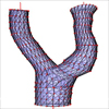 Modellbasierte Segmentierung von Weichgewebestrukturen in CT-Datensätzen de Halses
