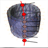 Reconstruction of Blood Vessels from Neck CT Datasets using Stable 3D Mass-Spring Models