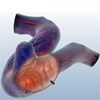 The FLOWLENS: A Focus-and-Context Visualization Approach for Exploration of Blood Flow in Cerebral Aneurysms