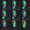 The File-Card-Browser View for Breast DCE-MRI Data