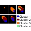 Adapted Spectral Clustering for Evaluation and Classification of DCE-MRI Breast Tumors
