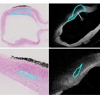 Histology-Based Evaluation of Optical Coherence Tomographic Charateristics of the Cerebral Artery Wall via Virtual Inflating