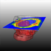 Novel Methods for Parameter Based Analysis of Myocardial Tissue in MR-Images