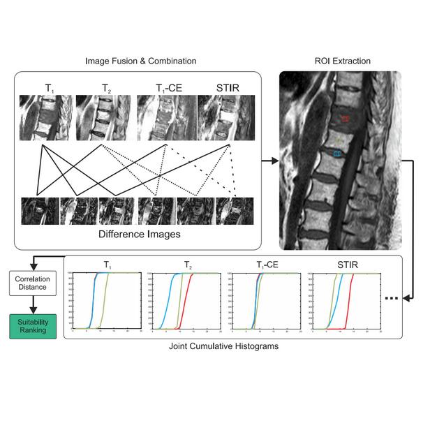 Computer-aided Detection of the Most Suitable MRI Sequences for Subsequent Spinal Metastasis Delineation