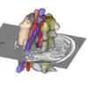 Interaktives 3D-basiertes Training der Planung von Eingriffen an der Wirbelsäule