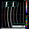 Visualization and Analysis of Lumbar Spine Canal Variability in Cohort Study Data