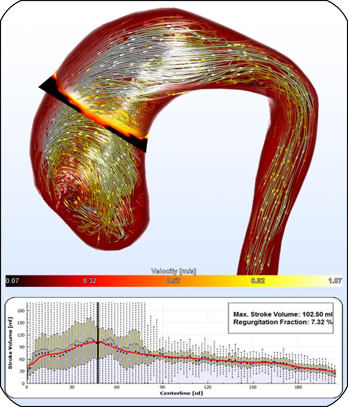 Robust Cardiac Function Assessment in 4D PC-MRI Data