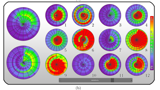 Two-Dimensional Plot Visualization of Aortic Vortex Flow in Cardiac 4D PC-MRI Data