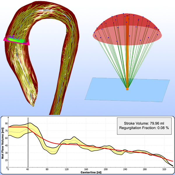 Robust Cardiac Function Assessment in 4D PC-MRI Data of the Aorta and Pulmonary Artery