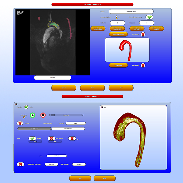 Guided Analysis of Cardiac 4D PC-MRI Blood Flow Data
